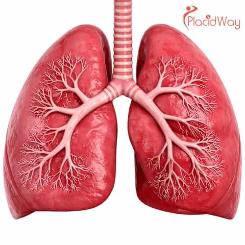 Why Americans Are Choosing Immunotherapy for Lung Cancer in Tijuana